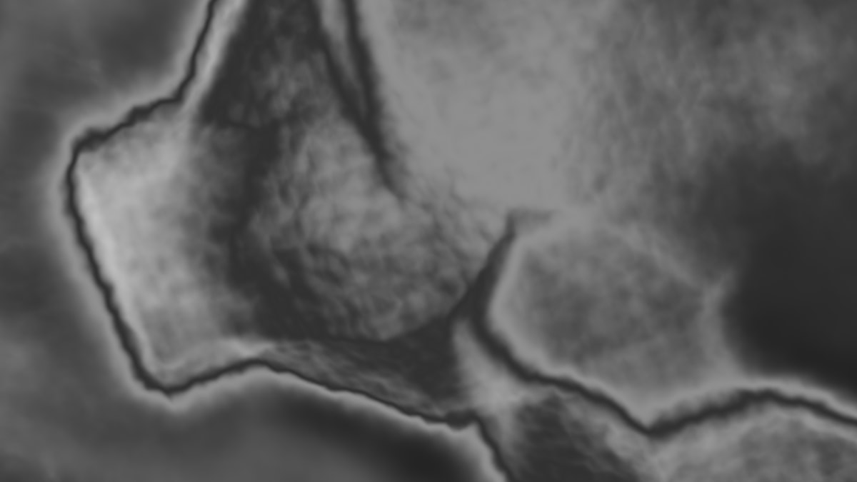 Age-related bone health changes